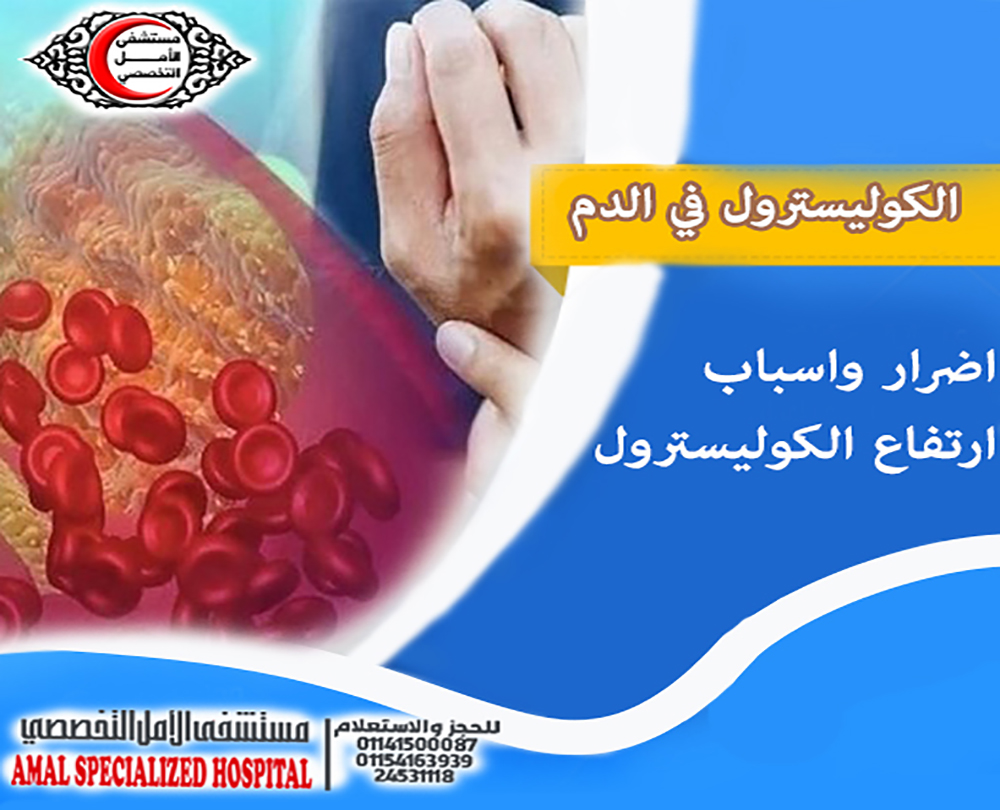 الكوليسترول في الدم 